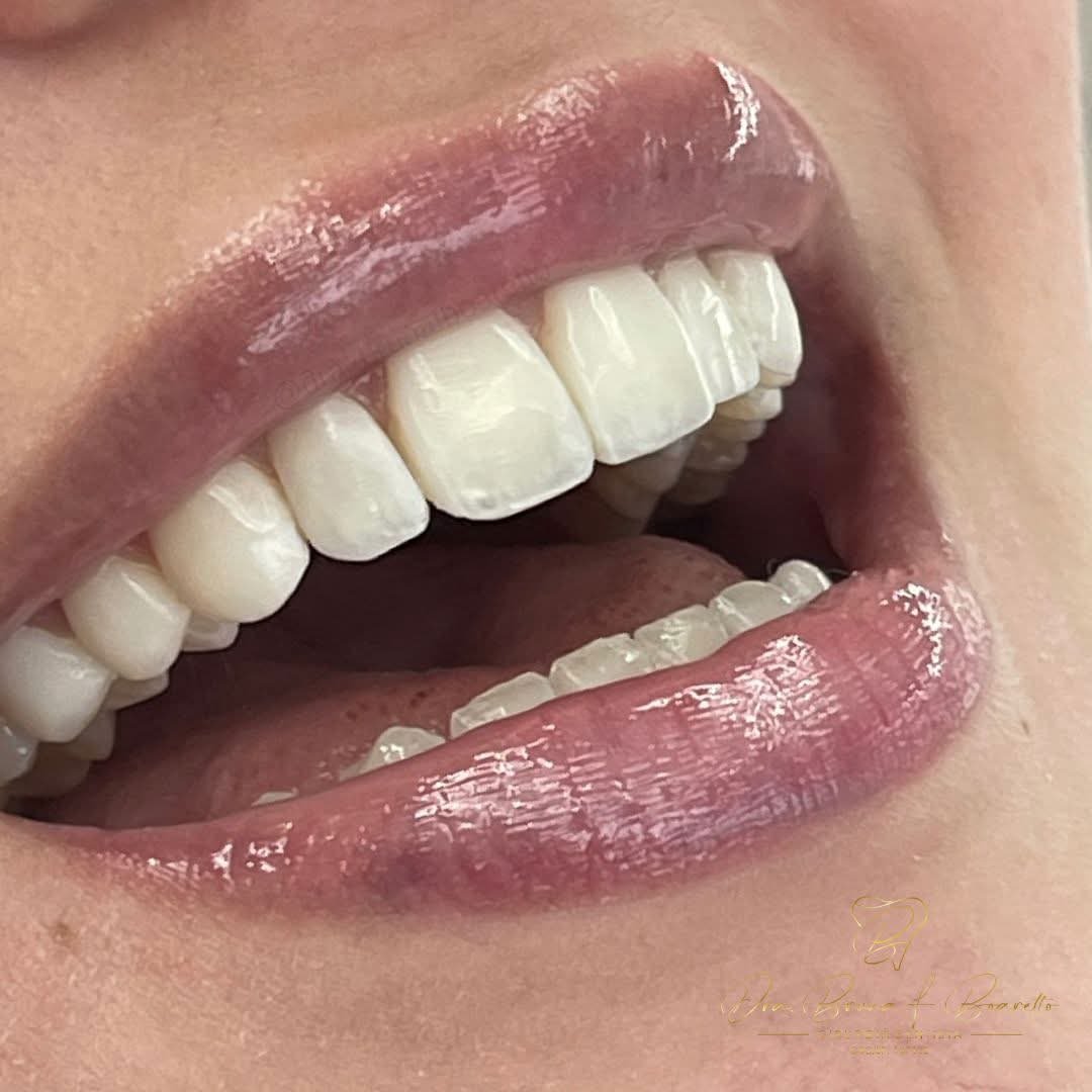 Resultado tratamento 1