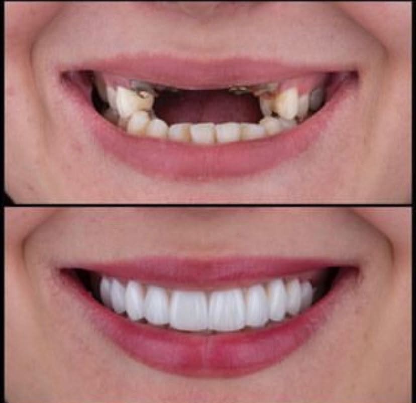 Resultado tratamento 3